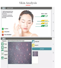 Analisis Kamera 200X HD Skin Moisture Skin Care Analyzer Portabel OEM